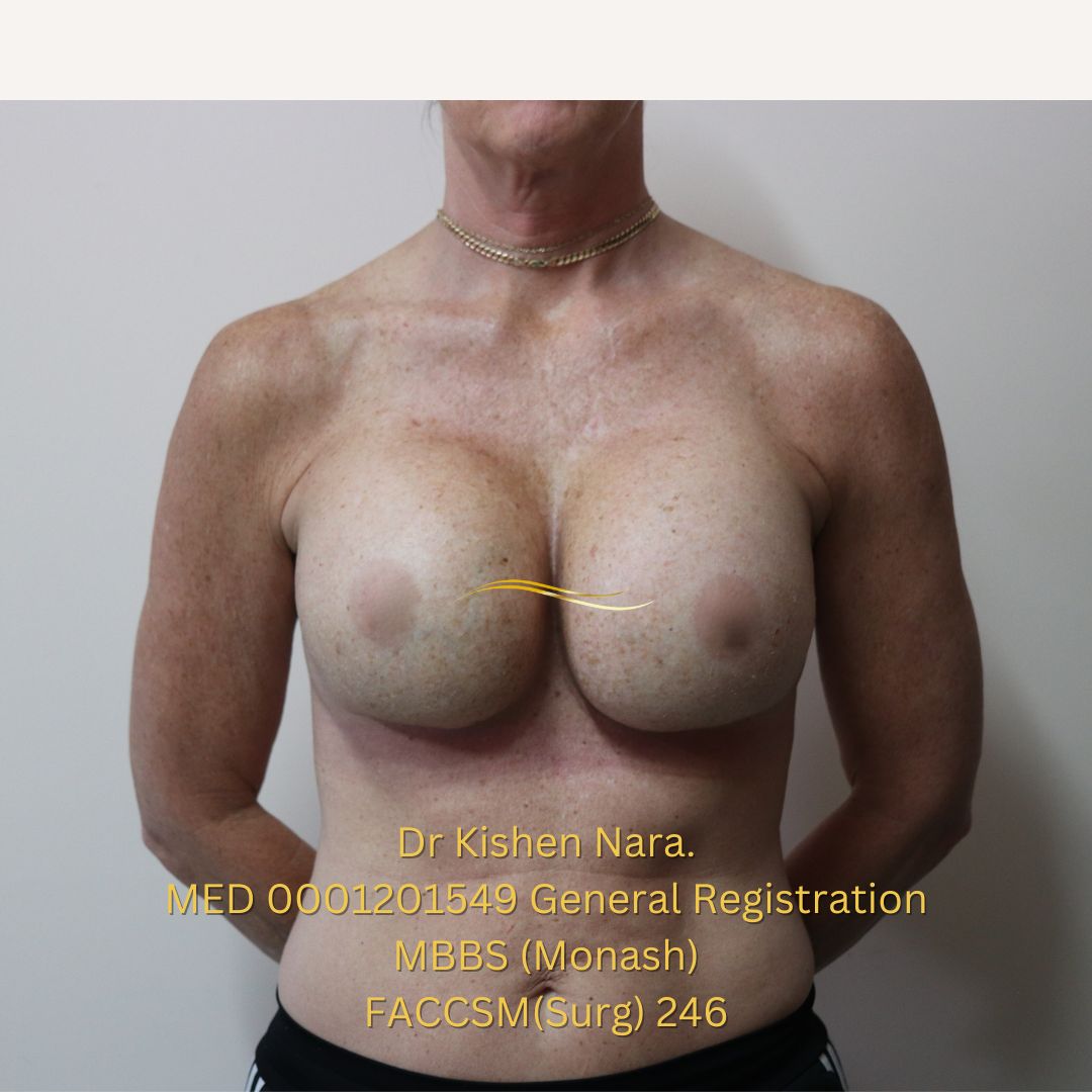 De-identified post-operative AP clinical photograph